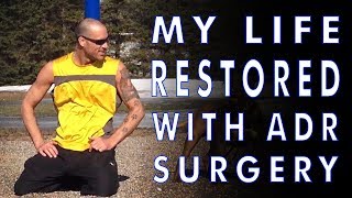 Lumbar Disc Replacement Surgery from Dr Ritter Lang and the Enande Team [upl. by Ahusoj]