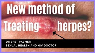 Possible new treatment for herpes [upl. by Obidiah]