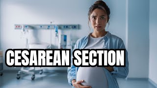 What You NEED To Know About CSections [upl. by Astrea792]