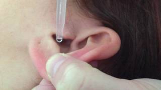 Fake Eardrum And Medication Residue Suction Ciloxan Or Cilodex [upl. by Stratton36]