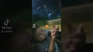 gumala bby namin part 12 congenital highlights [upl. by Pulchi]