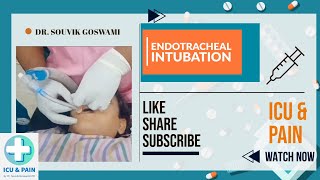 How to Perform Endotracheal Intubation A Clinical Demonstration [upl. by Eikcaj321]