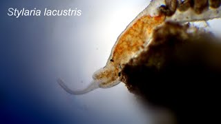 Stylaria lacustris under the microscope [upl. by Grounds953]