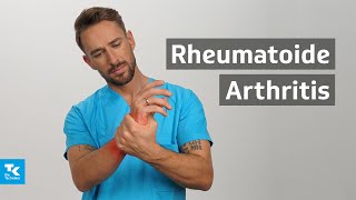 Rheumatoide Arthritis Rheuma verstehen Ursachen Symptome Diagnose amp Therapie  DocTommy [upl. by Dody126]