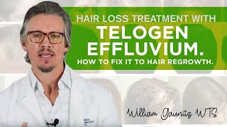 Telogen Effluvium Hair Loss  What is it How To Fix It Fast [upl. by Ihsakat410]