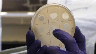 Titering Phage  spot and whole plate methods [upl. by Vassily]