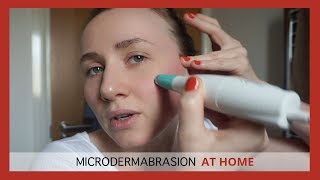 Silkn ReVit Microdermabrasion Review Plus Demo [upl. by Caines506]