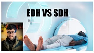 EDH vs SDH Basics of Epidural hematoma amp Subdural hematoma NEETPG INICET MBBS MD RADIOLOGY [upl. by Bink]