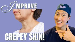 How To Improve Crepey Skin Holistically [upl. by Chemesh]