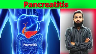 Pancreatitis  causes symptoms diagnosis treatment pathology  lecture In Urdu amp Hindi [upl. by Hobey]