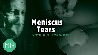 Meniscus Tears  Everything you need to know [upl. by Somisareg983]