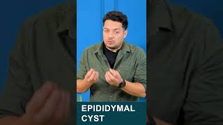 what is epididymal cyst varicocele epididymalcyst himanshudhawan maleinfertility shorts [upl. by Oisorbma]