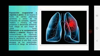 ENFISEMA PULMONAR [upl. by Liarret]