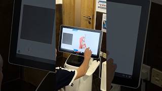 Dental Scan Demo on Model [upl. by Borgeson]