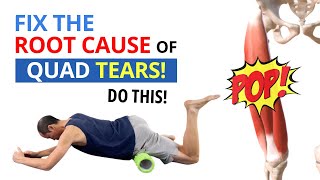 4 Exercises to Fix Quadriceps Strains Tendonitis amp Tears for GOOD [upl. by Airtal]