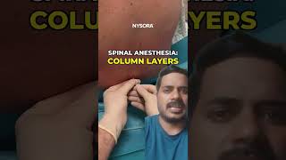 Spinal Anesthesia Layers  doctor anesthesia shortsfeed shortsviral [upl. by Alegnave]