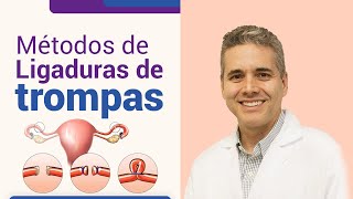 Métodos de ligadura de trompas l Dr Juan Luis Giraldo [upl. by Estell]