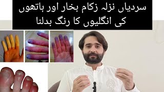 سردی سے ہاتھ پاؤں میں سوج ، جَلَن کھجلی محسُوس ہوناChilblain and raynaud│Sign Symptoms│Treatment [upl. by Veta]