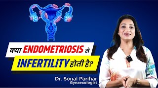 Endometriosis amp Infertility  Medicine ya surgery  Kya better option Hai  Sonal Parihar [upl. by Heisser]