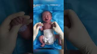 The nurse helped the newborn check his body The newborns small body is very cute [upl. by Stevy]