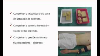 umh1723 201213 Lec015a Electrodiagnóstico de estimulación Metodología de las curvas I  t [upl. by Ahsam]