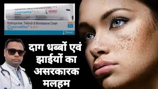 Ointment for melasma। Cosmelite ointment review Hydroquinone Tretinoin amp Mometasone cream। uses। [upl. by Dorine668]