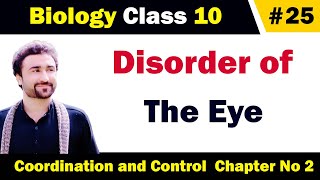 Disorder of eye class 10 biology  short sightedness and long sightedness explained in urdu [upl. by Soluk1]