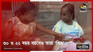 ৩০ ও ২২ বছর বয়সেও তারা শিশু  Chuadanga  Putul Meye  Deepto News [upl. by Harriette959]