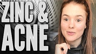 Why Everyone With Acne Should Try Zinc  Natural Treatment for Acne [upl. by Keon]