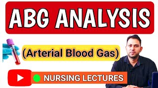 ABG ANALYSIS  Arterial Blood Gas hindi  abg analysis procedure  allen test  abg sampling [upl. by Suilenrac614]