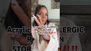 Acrylic Nails ALLERGIC REACTION STORYTIME PT1 shorts acrylicnails allergicreaction [upl. by Christin]