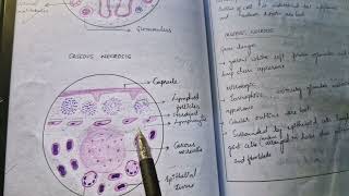 TB lymph node histopathology [upl. by Ulises]