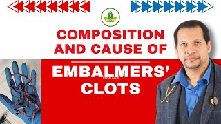 Embalmers Clots EXPOSED Whats Really Causing Them [upl. by Margetts]