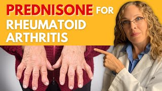 Managing Rheumatoid Arthritis with Prednisone Dosage Effectiveness and Side Effects [upl. by Isaak]