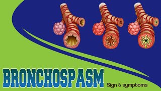 Bronchospasm  Risk factors  Management anaesthesia medicalstudent [upl. by Yolande377]