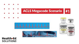 ACLS Megacode Scenario 1 Supraventricular Tachycardia SVT [upl. by Kappenne237]