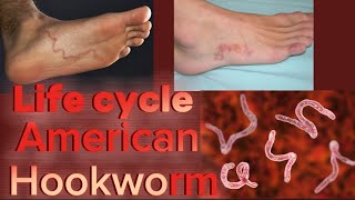 Life Cycle of American Hookworm  Necator Americanus  Phylum Nematoda  English [upl. by Liatris]