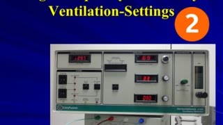 36 HFO Settings [upl. by Steddman]