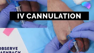 Intravenous IV cannulation  OSCE Guide  UKMLA  CPSA [upl. by Agnola]