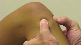 ACL Exam Lachmans Test Pivot Shift Drawer Test performed by Dr Eric Janssen [upl. by Sowell]