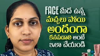 Face మీద ఉన్న మచ్చలు పోయి అందంగా కనపడాలి అంటే ఇలా చేయండి  Skin Care  Skin Care Tips amp Tricks [upl. by Adnilim]