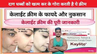 Kaylite Cream Ke Fayde l Kaylite Cream Lagane Se Kya Hota Hai  Kaylite Cream Use in Hindi l [upl. by Dunaville]