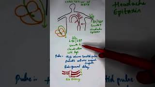 Coarctation of Aorta [upl. by Anaigroeg]