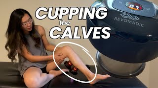 Calf Pain GONE with REVO Smart Cupper│SelfCupping at Home [upl. by Pahl303]