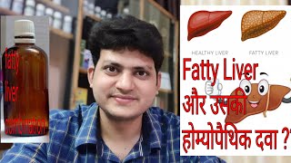 Fatty liver  Homeopathic Medicine for Fatty liver  My Combination [upl. by Wixted564]