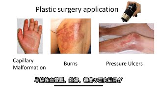 Capillaroscope Essentials 4 Plastic Surgery Research Dr Kento Yamamoto GOKO Webinar for IMC [upl. by Elehcar554]