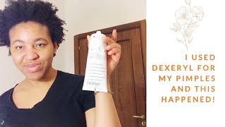 Can Dexeryl combat acne or pimple Yes or No [upl. by Eeladnerb980]