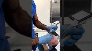 Intubation procedure ytshorts awareness doctor [upl. by Alleyne813]