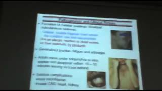 Dr Azza Parasitology Helminths Nematodes 8 Subcutaneous Filaria YouTube [upl. by Farr916]