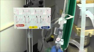 How to Setup an Arterial Line Transducer [upl. by Bobine]